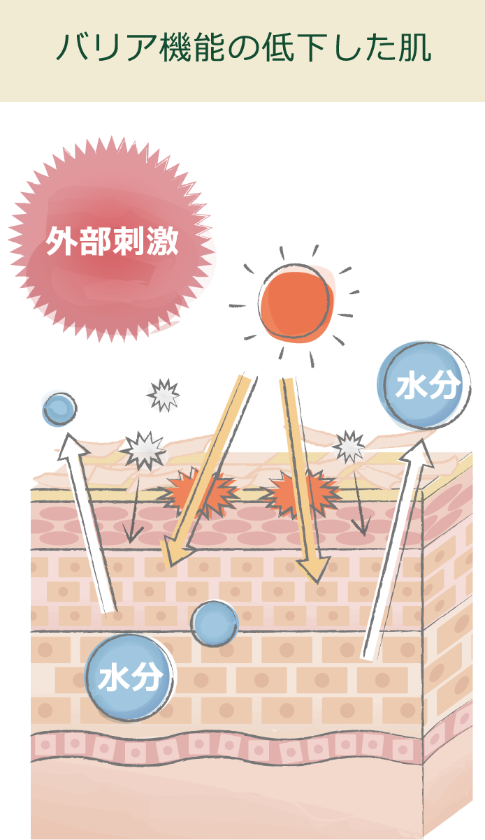 バリア機能の低下した肌の様子